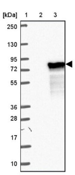 ZNF394 Antibody, Novus Biologicals 25 &mu;L, Unlabeled:Antibodies, Polyclonal